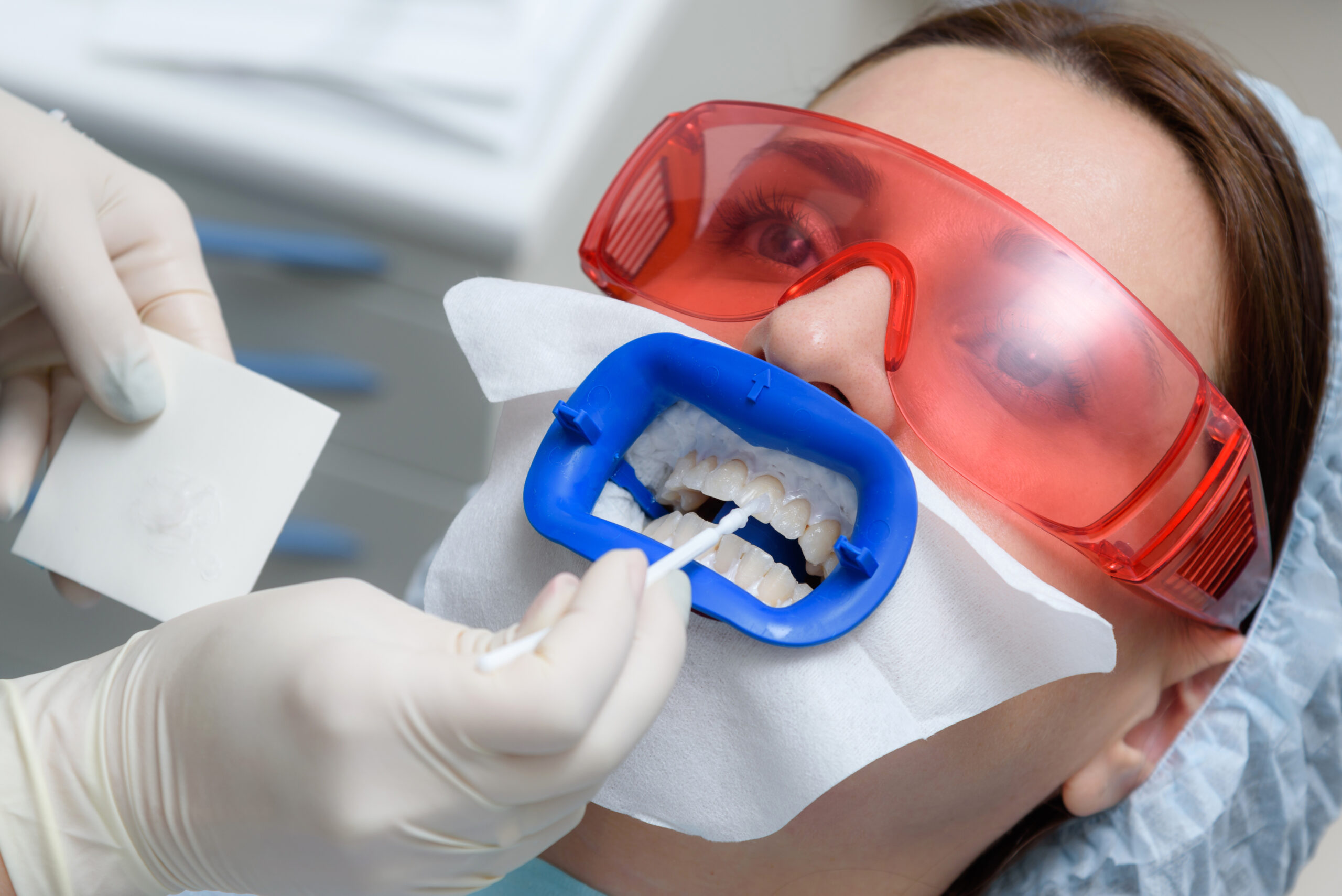 there is a preparation of the oral cavity to bleaching with the help of an ultraviolet lamp. Close-up